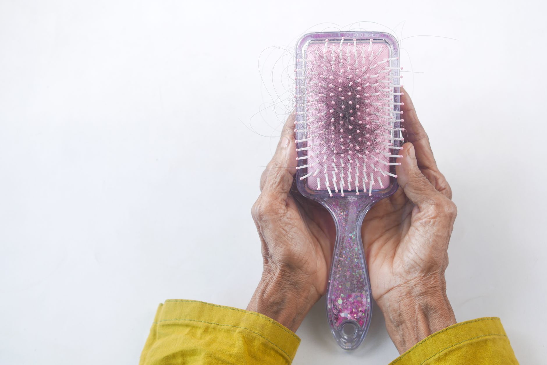 Queda excessiva de cabelo exige investigação médica e de saúde